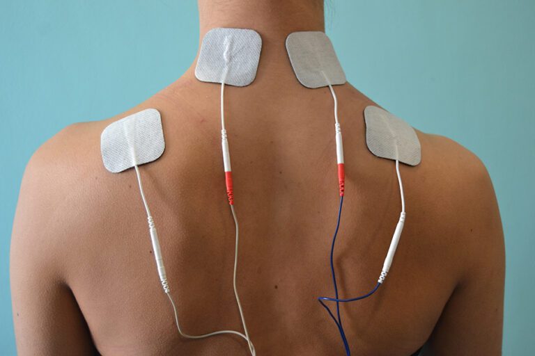 Sesión de electroterapia TENS en la espalda, clínica de fisioterapia en Lugo