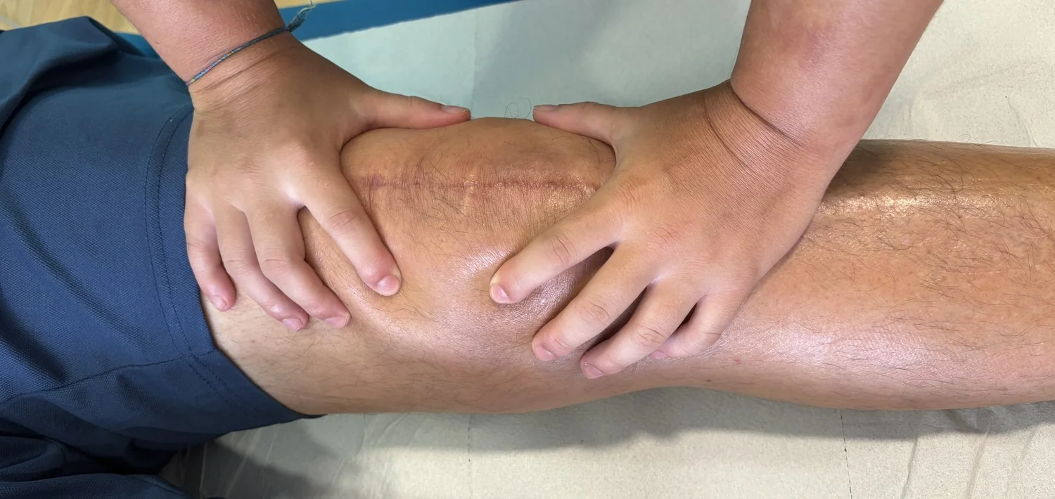 Trabajo manual sobre la cicatriz de una rodilla operada en la clínica de fisioterapia de Lugo