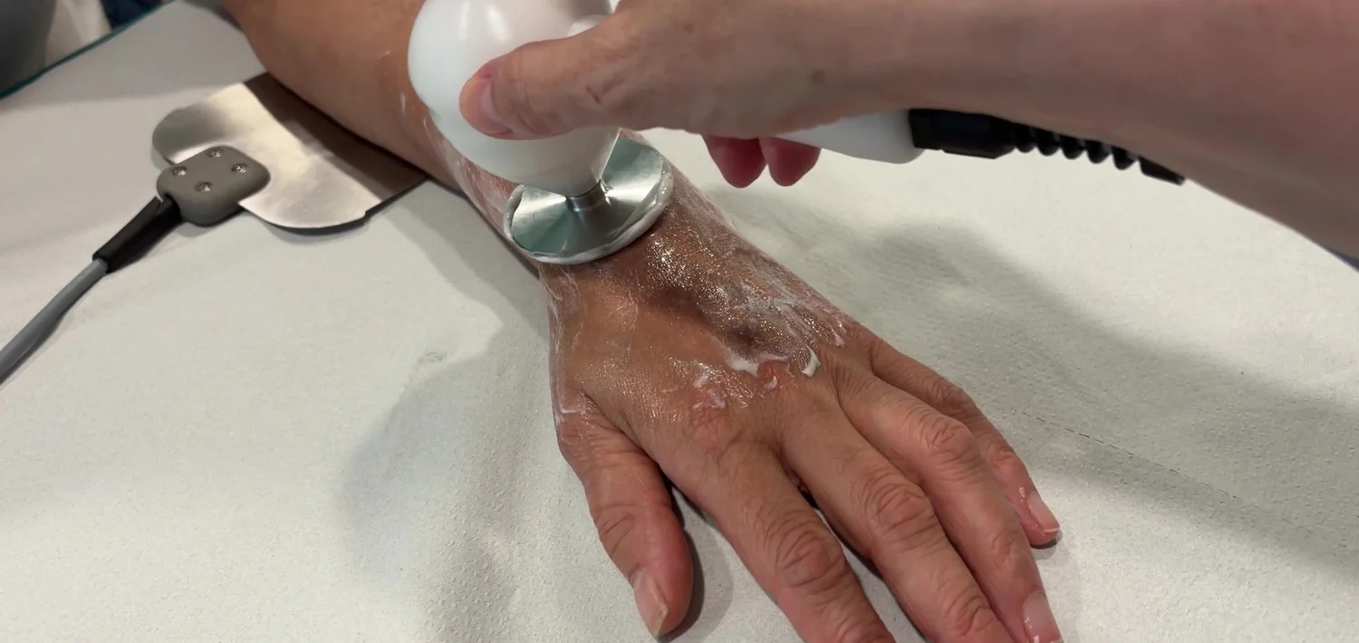Aplicación de diatermia sobre la mano con cabezal capacitivo en la clínica de Lugo