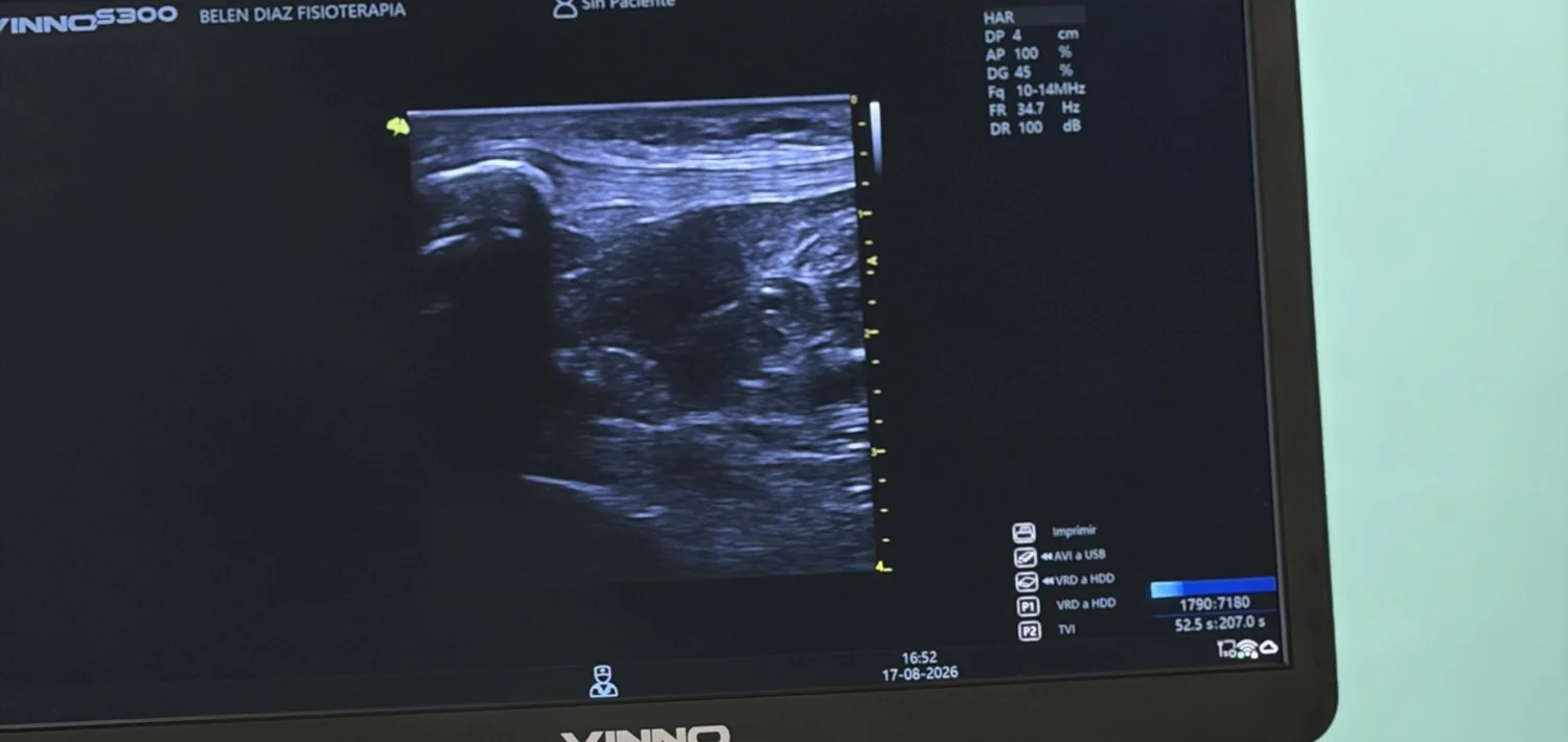 Monitor del ecógrafo mostrando una imagen de ecografía musculoesquelética